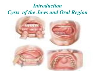 1
Introduction
Cysts of the Jaws and Oral Region
 