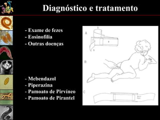 Diagnóstico e tratamento
- Exame de fezes
- Eosinofilia
- Outras doenças
- Mebendazol
- Piperazina
- Pamoato de Pirvíneo
- Pamoato de Pirantel
 