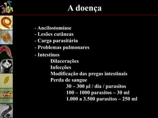 A doença
- Ancilostomíase
- Carga parasitária
- Problemas pulmonares
- Intestinos
Dilacerações
Infecções
Modificação das pregas intestinais
Perda de sangue
30 – 300 µl / dia / parasitos
100 – 1000 parasitos – 30 ml
1.000 a 3.500 parasitos – 250 ml
- Lesões cutâneas
 