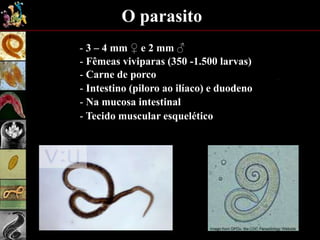O parasito
- 3 – 4 mm ♀ e 2 mm ♂
- Fêmeas viviparas (350 -1.500 larvas)
- Carne de porco
- Na mucosa intestinal
- Tecido muscular esquelético
- Intestino (piloro ao ilíaco) e duodeno
 