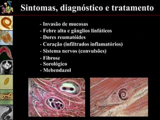 Sintomas, diagnóstico e tratamento
- Invasão de mucosas
- Febre alta e gânglios linfáticos
- Dores reumatóides
- Sistema nervos (convulsões)
- Fibrose
- Coração (infiltrados inflamatórios)
- Sorológico
- Mebendazol
 
