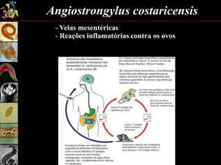 Angiostrongylus costaricensis
- Veias mesentéricas
- Reações inflamatórias contra os ovos
 