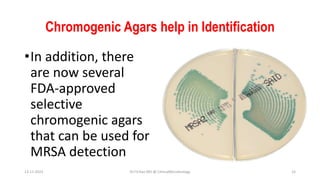Chromogenic Agars help in Identification
•In addition, there
are now several
FDA-approved
selective
chromogenic agars
that can be used for
MRSA detection
13-11-2023 Dr.T.V.Rao MD @ ClinicalMicrobiology 15
 