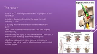 4
The reason
Back in 2012 I was diagnosed with two bulging disc in the
lower back.
A bulging disk extends outside the space it should
normally occupy
A bulging disc in the lower back could lead to severe
pain.
Then came that time when the doctor said back surgery
Laminectomy.
Laminectomy is surgery to remove the lamina. This is part of
the bone that makes up a vertebra in the spine.
Also known as decompression surgery, laminectomy
enlarges your spinal canal to relieve pressure on the spinal
cord or nerves.
 