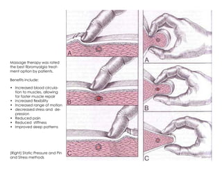 Massage therapy was rated
the best fibromyalgia treat-
ment option by patients.
Benefits include:
•	 Increased blood circula-
tion to muscles, allowing
for faster muscle repair
•	 increased flexibility
•	 Increased range of motion
•	 decreased stress and de-
pression
•	 Reduced pain
•	 Reduced stiffness
•	 Improved sleep patterns
(Right) Static Pressure and Pin
and Stress methods
 