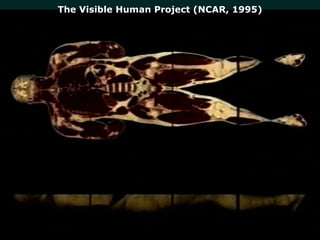 The Visible Human Project (NCAR, 1995) 