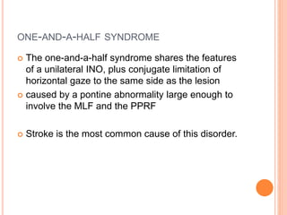 ONE-AND-A-HALF SYNDROME
 The one-and-a-half syndrome shares the features
of a unilateral INO, plus conjugate limitation of
horizontal gaze to the same side as the lesion
 caused by a pontine abnormality large enough to
involve the MLF and the PPRF
 Stroke is the most common cause of this disorder.
 