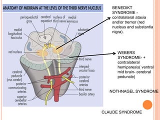 WEBERS
SYNDROME- +
contralateral
hemiparesis( ventral
mid brain- cerebral
peduncle)
BENEDIKT
SYNDROME -
contralateral ataxia
and/or tremor (red
nucleus and substantia
nigra).
CLAUDE SYNDROME
NOTHNAGEL SYNDROME
 
