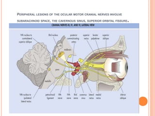 PERIPHERAL LESIONS OF THE OCULAR MOTOR CRANIAL NERVES INVOLVE
SUBARACHNOID SPACE, THE CAVERNOUS SINUS, SUPERIOR ORBITAL FISSURE.
 
