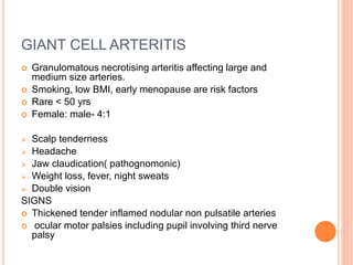 GIANT CELL ARTERITIS
 Granulomatous necrotising arteritis affecting large and
medium size arteries.
 Smoking, low BMI, early menopause are risk factors
 Rare < 50 yrs
 Female: male- 4:1
 Scalp tenderness
 Headache
 Jaw claudication( pathognomonic)
 Weight loss, fever, night sweats
 Double vision
SIGNS
 Thickened tender inflamed nodular non pulsatile arteries
 ocular motor palsies including pupil involving third nerve
palsy
 