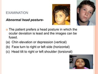 EXAMINATION
Abnormal head posture-
 The patient prefers a head posture in which the
ocular deviation is least and the images can be
fused.
(a) Chin elevation or depression (vertical)
(b) Face turn to right or left side (horizontal)
(c) Head tilt to right or left shoulder (torsional)
 
