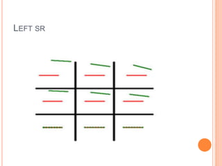 LEFT SR
 