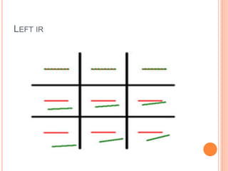 LEFT IR
 