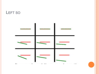 LEFT SO
 