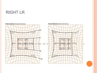 RIGHT LR
 