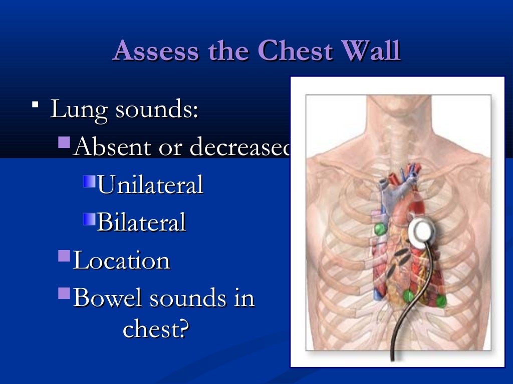 chest trauma management