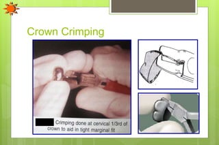 Crown Crimping
 