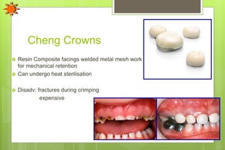Cheng Crowns
 Resin Composite facings welded metal mesh work
for mechanical retention
 Can undergo heat sterilisation
 Disadv: fractures during crimping
expensive
 