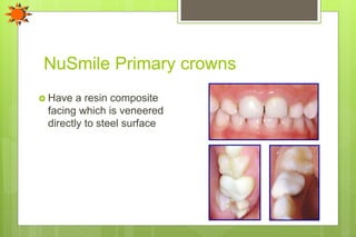 NuSmile Primary crowns
 Have a resin composite
facing which is veneered
directly to steel surface
 