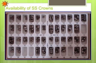Availability of SS Crowns
 