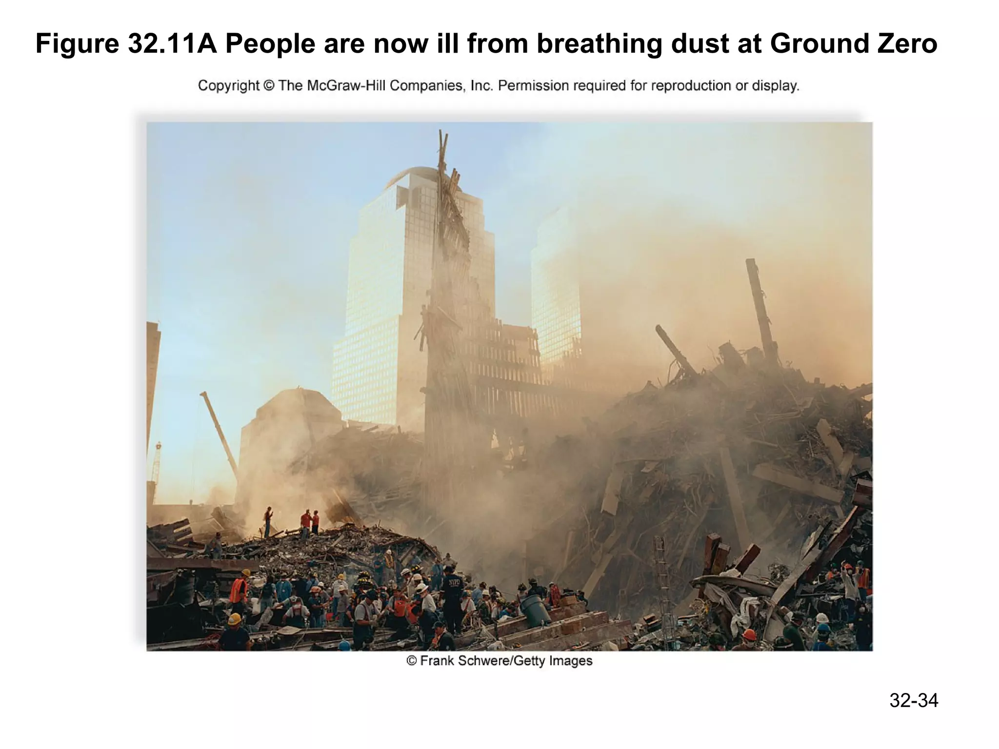 Figure 32.11A People are now ill from breathing dust at Ground Zero 32- 