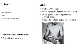 History
Trauma/fall
Pain
Inability to move arm
Neurovascular Examination
 Test axillary nerve function
P/E
‘’Flattened’ ’shoulder
Patient carries affected arm with other hand
 Empty glenoid fossa, compared with
contralateral side
Palpable dislocated head(anterior in axilla )
12
 