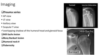Imaging
Trauma series
 AP view
 LT view
 Axillary view
 Scapular Y view
overlapping shadow of the humeral head and glenoid fossa
Hill-Sachs lesion
Bony Bankart lesion
Humeral neck #
Tuberosity
13
 