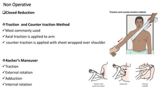 Non Operative
Closed Reduction
Traction and Counter traction Method
Most commonly used
Axial traction is applied to arm
 counter traction is applied with sheet wrapped over shoulder
Kocher’s Maneuver
Traction
External rotation
Adduction
Internal rotation 14
 