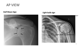 AP VIEW
Half Moon Sign Light bulb sign
20
 