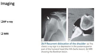 Imaging
AP x-ray
 MRI
25
 
