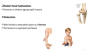 Radial Head Subluxation
Common in children age group(2-5 years)
Reduction
With thumb in antecubital space as a fulcrum
The forearm is supinated and flexed
30
 