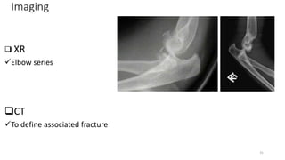 Imaging
 XR
Elbow series
CT
To define associated fracture
31
 