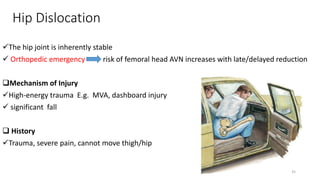 Hip Dislocation
The hip joint is inherently stable
 Orthopedic emergency risk of femoral head AVN increases with late/delayed reduction
Mechanism of Injury
High-energy trauma E.g. MVA, dashboard injury
 significant fall
 History
Trauma, severe pain, cannot move thigh/hip
35
 