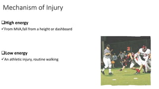 Mechanism of Injury
High energy
From MVA,fall from a height or dashboard
Low energy
An athletic injury, routine walking
47
 