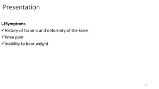 Presentation
Symptoms
History of trauma and deformity of the knee
Knee pain
Inability to bear weight
48
 