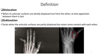 Definition
Dislocation
When its articular surfaces are wholly displaced one from the other, so that apposition
between them is lost.
Subluxation
Exists when the articular surfaces are partly displaced but retain some contact with each other.
5
 