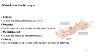 Closed reduction technique
Anterior
 Traction and anterior translation of femur
Posterior
 Traction,extension,and anterior translation of the tibia
Medial/Lateral
 Traction and medial or lateral translation
Rotatory
 Axial limb traction and rotation in the opposite direction of deformity
54
 