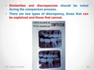 • Similarities and discrepancies should be noted
during the comparison process.
• There are two types of discrepancy, those that can
be explained and those that cannot.
D. Caroline Mohamed 21
 