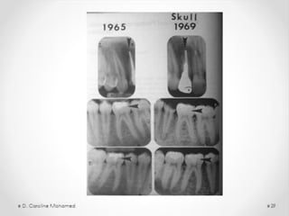 D. Caroline Mohamed 23
 