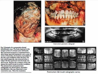 D. Caroline Mohamed 29
 