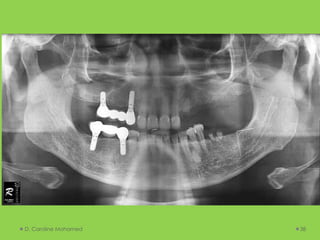 D. Caroline Mohamed 38
 