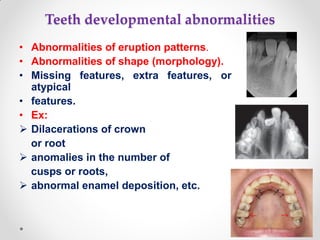 Teeth developmental abnormalities
• Abnormalities of eruption patterns.
• Abnormalities of shape (morphology).
• Missing features, extra features, or
atypical
• features.
• Ex:
 Dilacerations of crown
or root
 anomalies in the number of
cusps or roots,
 abnormal enamel deposition, etc.
 