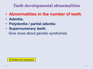 Teeth developmental abnormalities
• Abnormalities in the number of teeth.
• Adontia,
• Polydontia / partial adontia
• Supernumerary teeth.
Give clues about genetic syndromes
Ectodermal dysplasia
 