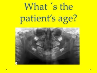What ´s the
patient’s age?
 