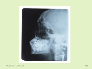 D. Caroline Mohamed 65
 