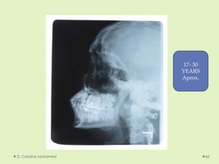 D. Caroline Mohamed 66
17- 30
YEARS
Aprox.
 