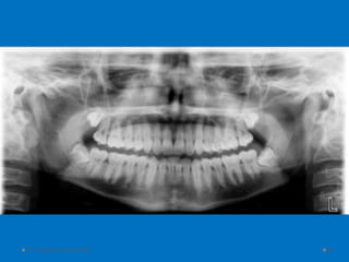 D. Caroline Mohamed 69
 