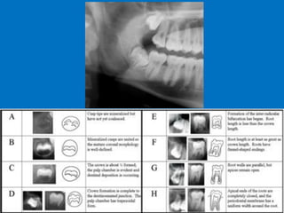 D. Caroline Mohamed 70
 