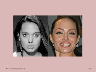 D. Caroline Mohamed 76
 