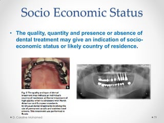 Socio Economic Status
• The quality, quantity and presence or absence of
dental treatment may give an indication of socio-
economic status or likely country of residence.
D. Caroline Mohamed 79
 